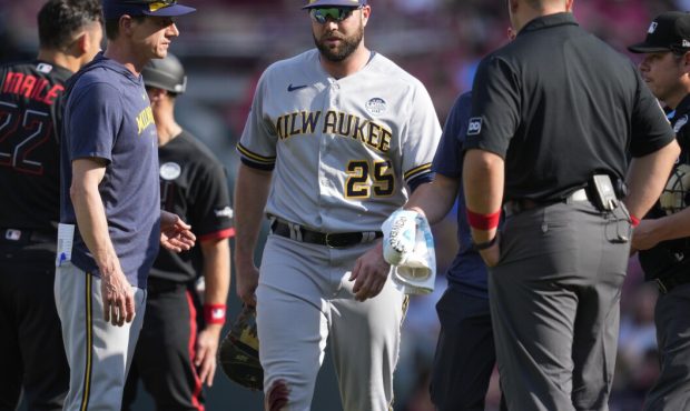 بازیکن سابق MLB پس از دچار مصدومیت پایان کار در ورزشگاه ، از Reds شکایت کرد بازیکن سابق MLB پس از دچار مصدومیت پایان کار در ورزشگاه ، از Reds شکایت کرد